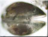 Ostracod