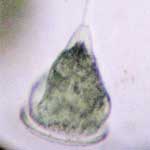 Vorticella