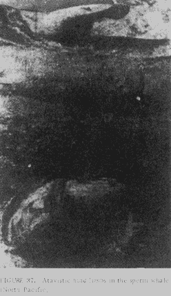 Rudimentary Hind Limbs on Whales - Figure 1