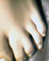 Toes shown from front.